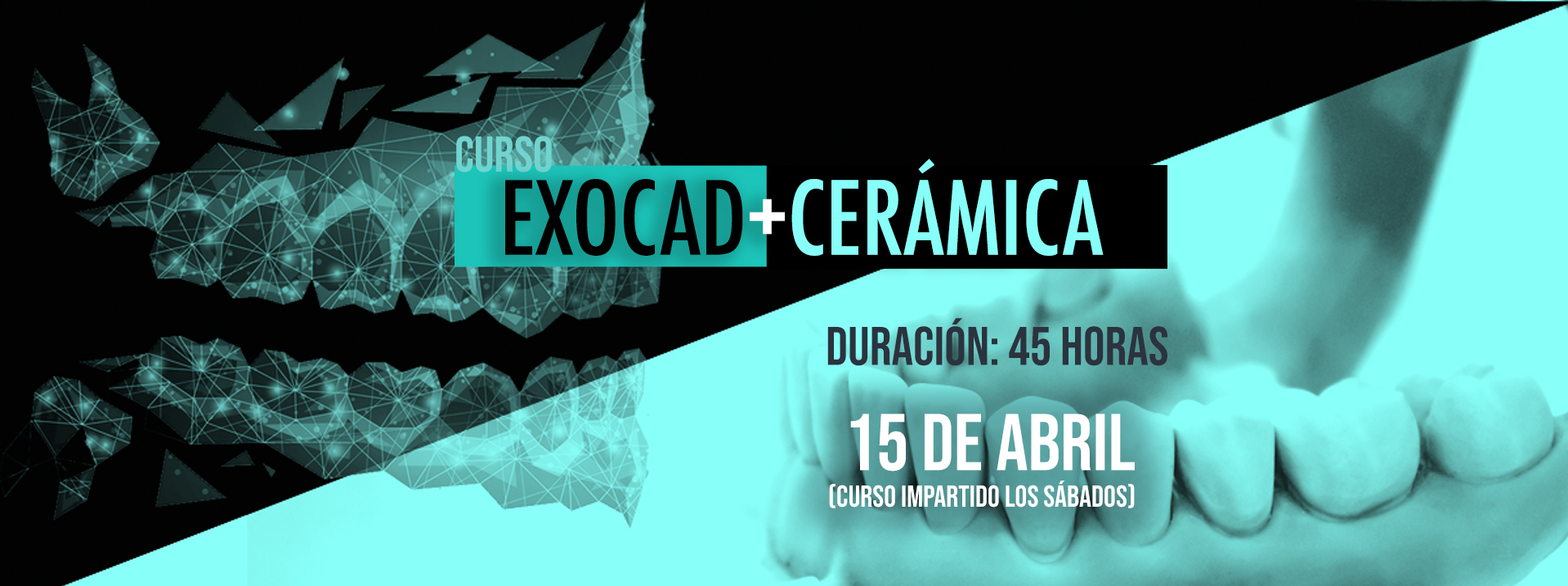 Curso EXOCAD+CERÁMICA - Ferrer Técnica Dental